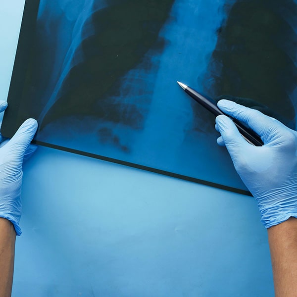 photo d'une radio tenue par un chirurgien suite à un adommage corporel, accompagnement de la victime par CPC associés
